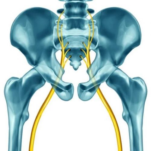 Qué es la ciática y cómo tratarla Clínica Lafuente Arcos